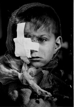 Injured Kurdish Boy (photo: Kaveh Golestan Foundation)